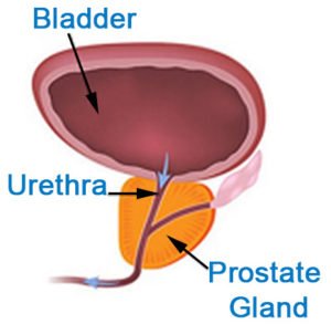 prostate | Profound Medical