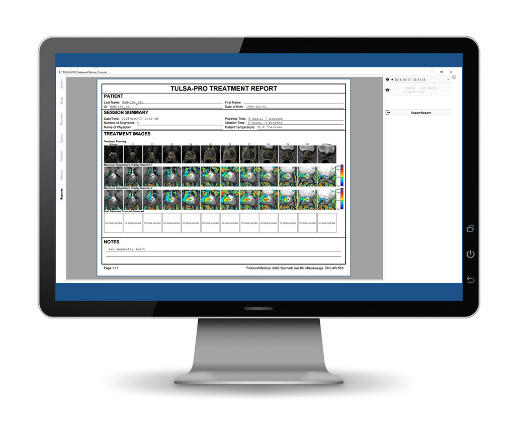 TSC 2.8 MONITOR_Reports01 Profound Medical